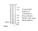 Product image for CBF &beta; Antibody