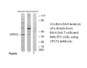 Product image for VPS72 Antibody