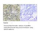 Product image for UBXD5 Antibody