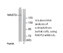 Product image for MAST2 Antibody