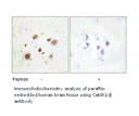 Product image for CaMK1-&beta; Antibody