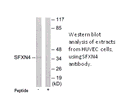 Product image for SFXN4 Antibody