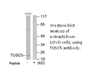 Product image for TUSC5 Antibody