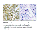 Product image for CKI-&alpha;1/L Antibody