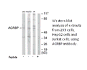 Product image for ACRBP Antibody