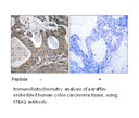 Product image for STEA2 Antibody