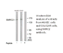 Product image for SMRC2 Antibody