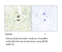 Product image for BRI3B Antibody