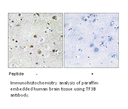 Product image for TF3B Antibody