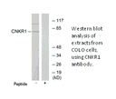 Product image for CNKR1 Antibody