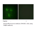 Product image for TMEPA Antibody