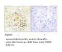 Product image for TMEPA Antibody