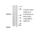 Product image for SERC2 Antibody