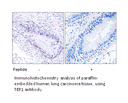 Product image for TEP1 Antibody