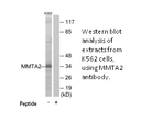 Product image for MMTA2 Antibody