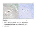 Product image for IPKB Antibody