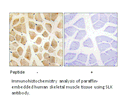 Product image for SLK Antibody