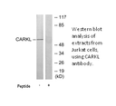 Product image for CARKL Antibody