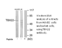 Product image for TBX22 Antibody