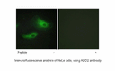 Product image for ADD2 Antibody