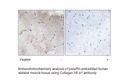 Product image for Collagen XII &alpha;1 Antibody