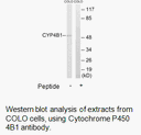 Product image for Cytochrome P450 4B1 Antibody