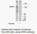 Product image for HER2 Antibody