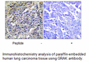 Product image for GRAK Antibody