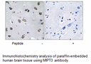 Product image for MIPT3 Antibody