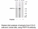 Product image for PRPF19 Antibody