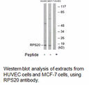 Product image for RPS20 Antibody