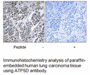 Product image for ATP5D Antibody