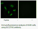 Product image for SLC27A5 Antibody