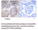 Product image for SLC27A5 Antibody