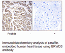 Product image for BRWD3 Antibody