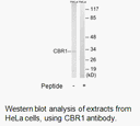 Product image for CBR1 Antibody