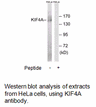 Product image for KIF4A Antibody