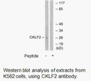 Product image for CKLF2 Antibody