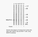 Product image for NDUFV2 Antibody