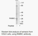 Product image for RAB6C Antibody