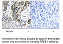 Product image for RREB1 Antibody