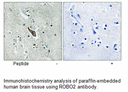 Product image for ROBO2 Antibody