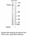 Product image for TLK2 Antibody