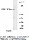 Product image for PPP2R3B Antibody