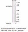 Product image for SLC5A2 Antibody