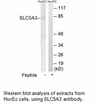 Product image for SLC5A3 Antibody