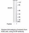 Product image for SVOP Antibody