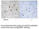 Product image for MTERF Antibody