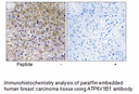 Product image for ATP6V1B1 Antibody