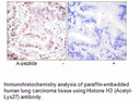 Product image for Histone H3 (Acetyl-Lys27) Antibody